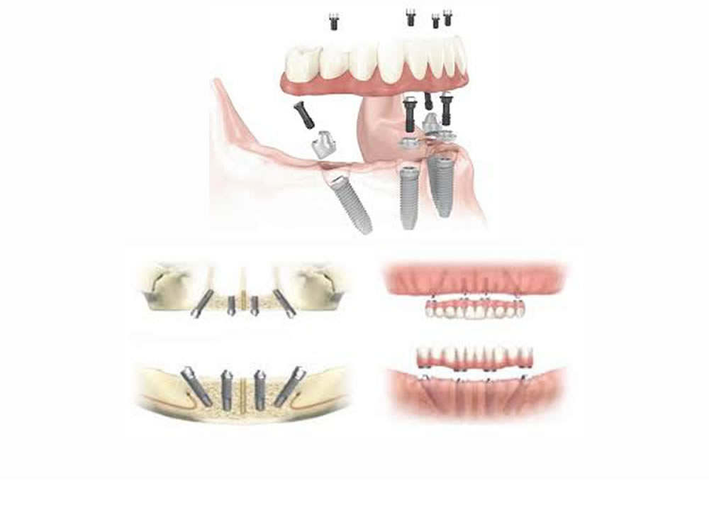 studio_dentistico_anaclerico_13